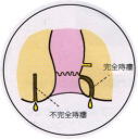 낤